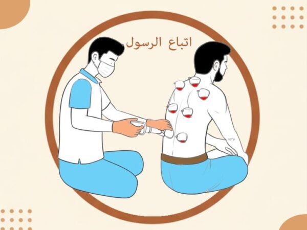 Bekam Gratis: Ikhtiar, Sunnah, dan Kepedulian